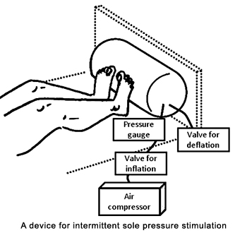 A device for intermittent sole pressure stimulation