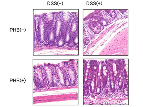 PHB供与による大腸の粘膜上皮の変性の抑制
